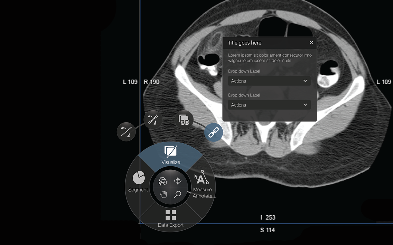 Radial Menu